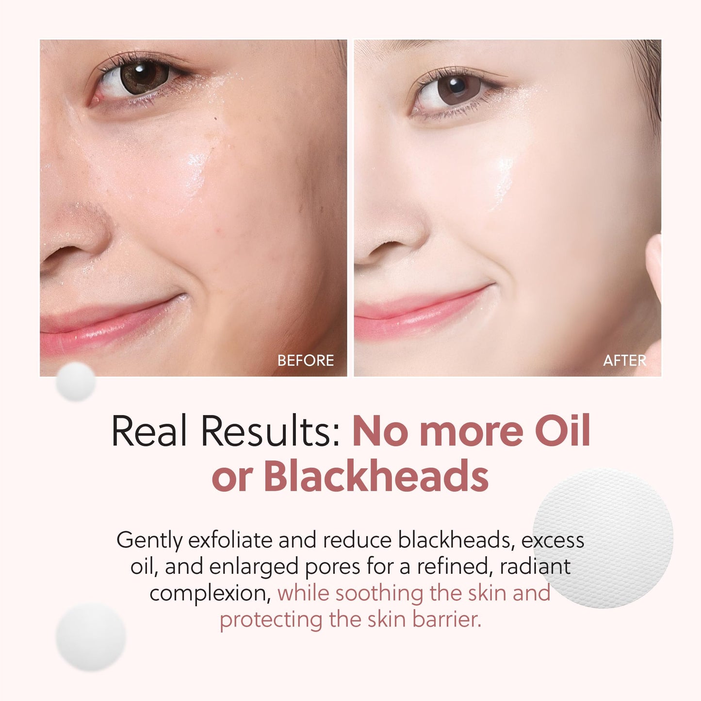 QUIA Dual-Action Toner Pads – Exfoliate and Hydrate Pores in One Step – Soothing PHA Formula for Sensitive Skin – Reduces Blackheads and Blemishes- 70 Textured Pads – Korean Skincare