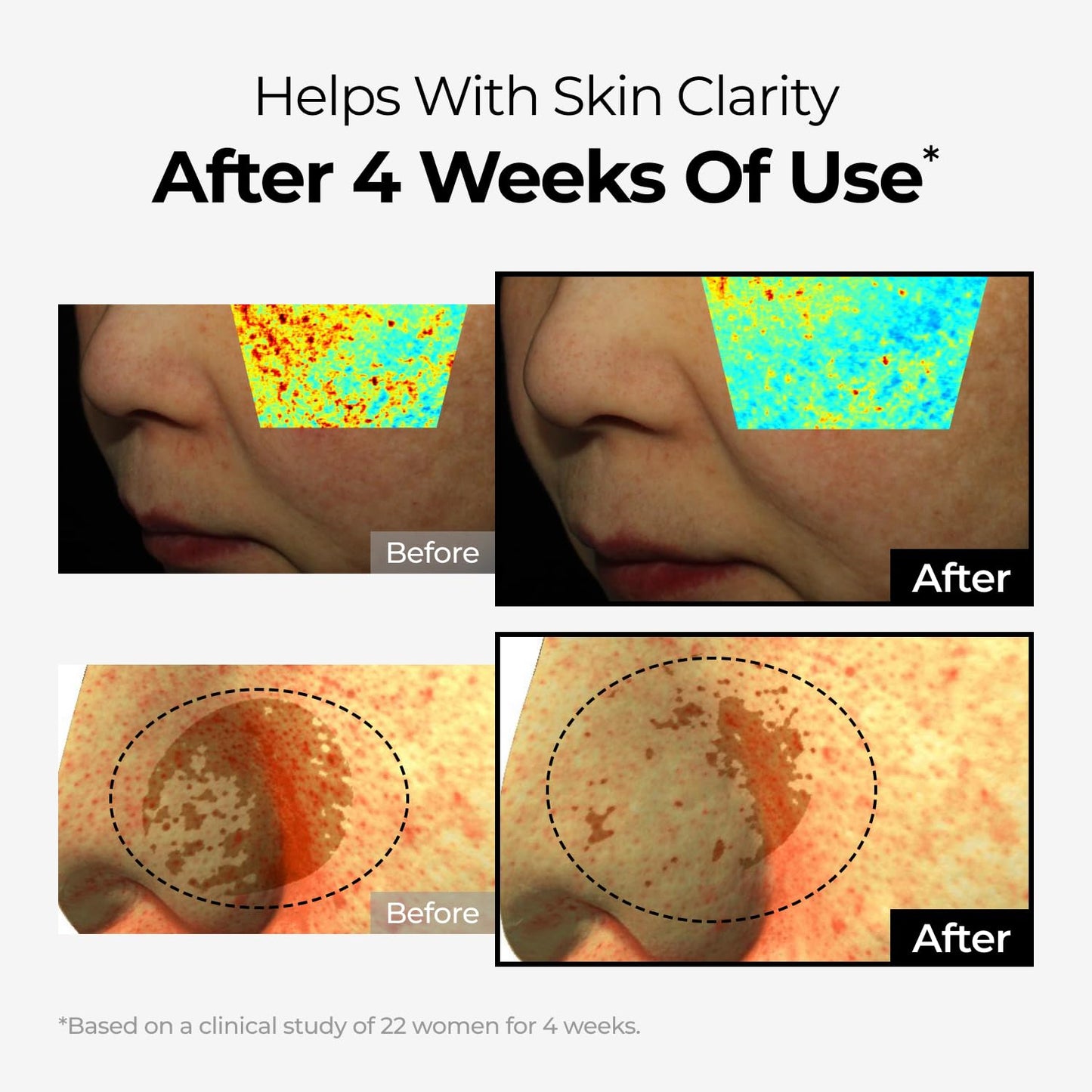 DOMINAS Niacinamide & Tranexamic Acid Cream | Korean Skincare for Even Skin Tone | With Bakuchiol & Panthenol (1.76oz)