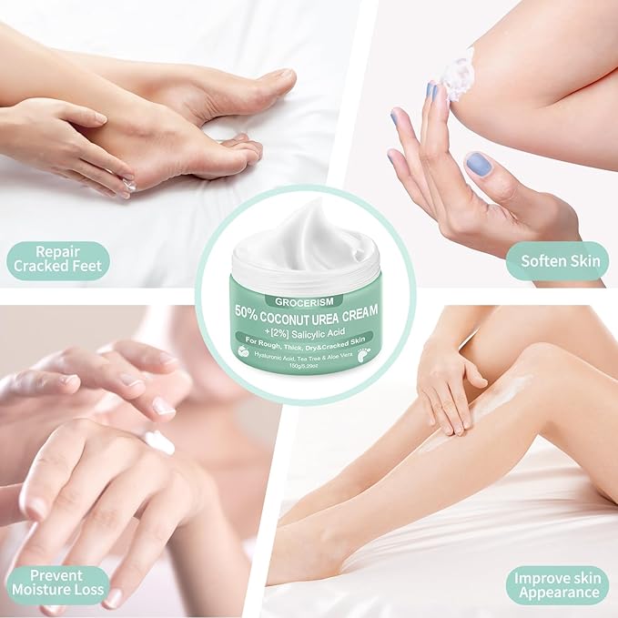 Urea Cream 50 Percent for Feet with Coconut 5.29 oz || Foot & Hand Cream Maximum Strength with 2% Salicylic Acid, Tea Tree and Aloe Vera for Deep Moisturizing and Callus Removing