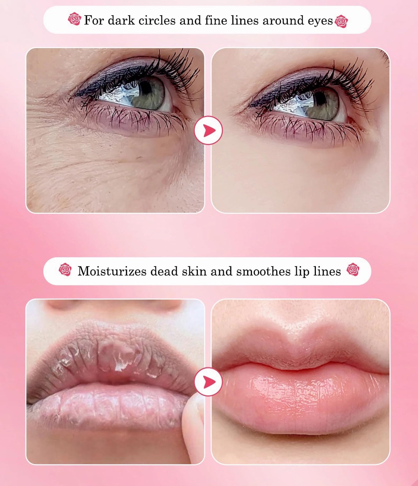 10 Pair Under Eye Mask & 10 Pair Lip Mask Skincare Set, Rose Pink Lip Patches & Under Eye Patches for Puffy Eyes, Dark Circles, Dry Lips Lines, Deep Hydrating Moisturizing, Gifts for Mom Women