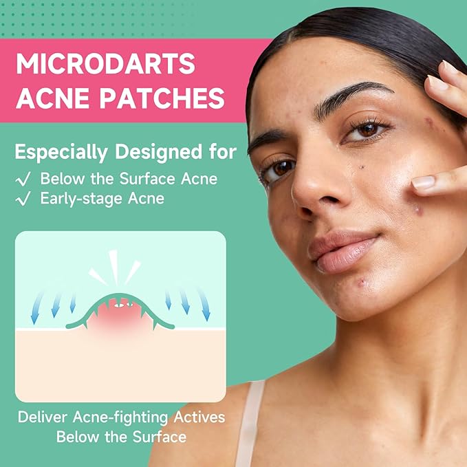 36-Count Microdart Acne Patches, Hydrocolloid Pimple Patches with Salicylic Acid & Madecossoside, Microdart Zit Patches for Deep Blemishes & Early Stage Acne (Patented)