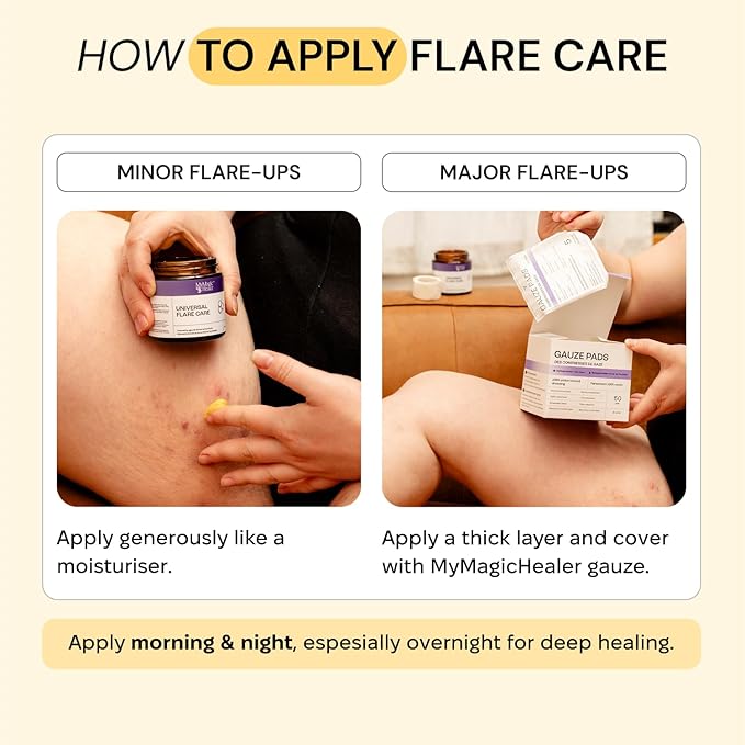 Universal Flare Care | Drawing Salve for HS, Boils, Cysts, Hemorrhoids, Pilonidal Cyst, Abscess | Anti-Chafing, Wound Care, Relief for Itching Skin w/Propolis & Egg Yolk Extract 2 oz