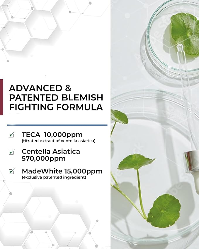 Centellian 24 Expert Ampoule (Season 2, 0.2fl oz x 4 pcs) - Korean Serum for Face. Soothing, Even Tone, Dry Sensitive Skin. TECA, Centella Asiatica, Gotu Kola