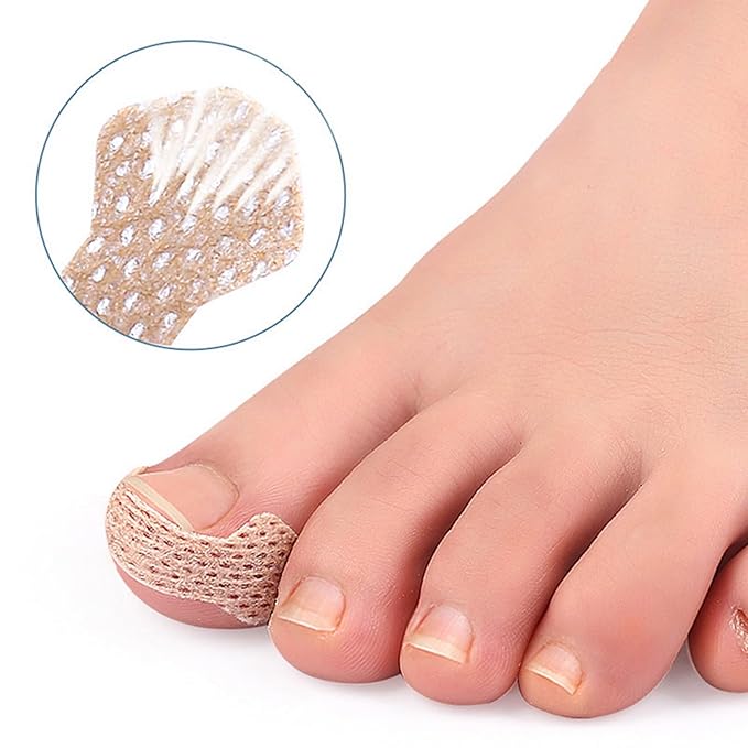 Ingrown Toenail Treatment: 120Pcs Breathable