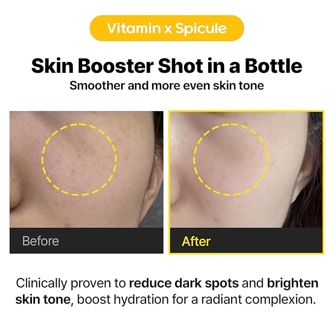 Cell Fusion C Toning C Vita Shot Ampoule, 15% Vitamin C + Spicule 300 Shot, Skin Booster Serum for Face, Exfoliation & Dark Spots, 20g / 0.7 oz.