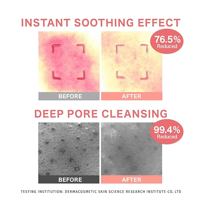 Barrier Enhancing Cleanser, Gentle Deep Pore Cleansing, Moisture Retention, Soothing, pH balance with Panthenol, Triple Hyaluronic Acid, SkinCare for Sensitive & Dry Skin(6.42 Fl. Oz/190ml)
