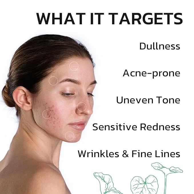 Centella Moisturizer Phytocin Cream Salmon PDRN Cream Face Soothing Hydration Barrier Repair Calming, for Acne Prone & Sensitive Skin with Ceramide, B5 (30ml)
