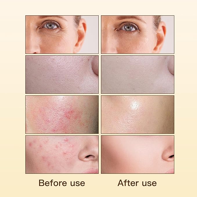 Madagascar Centella, Facial Serum for face, Natural Extraction of Bakuchiol, Centella Asiatica Extract for Soothing Sensitive& Acne-Prone Skin, for Scars, Moisturizing& Firming- 45ml