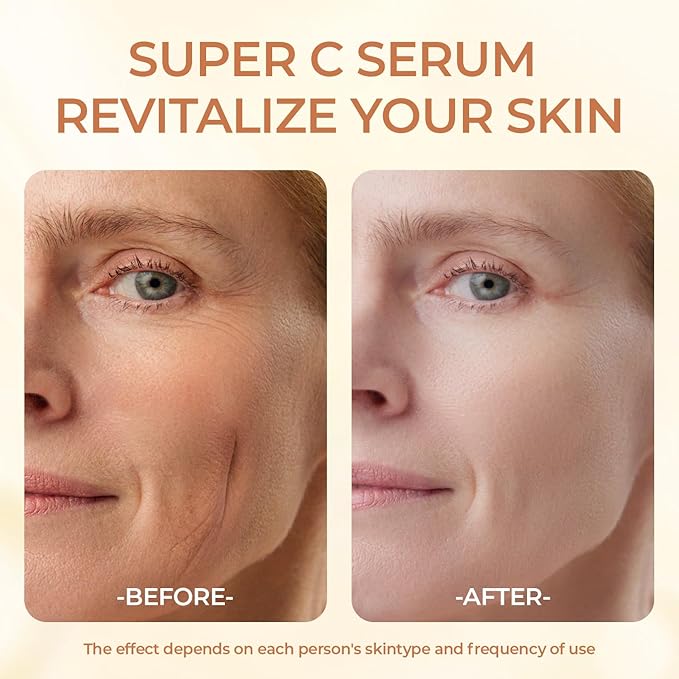Super Vitamin C Serum for Women Mature Skin- Hydrating Anti-Aging with Vitamin C Caffeine - Facial Skin Care Over 50 60 70, Firming, Lifting, Smoothing