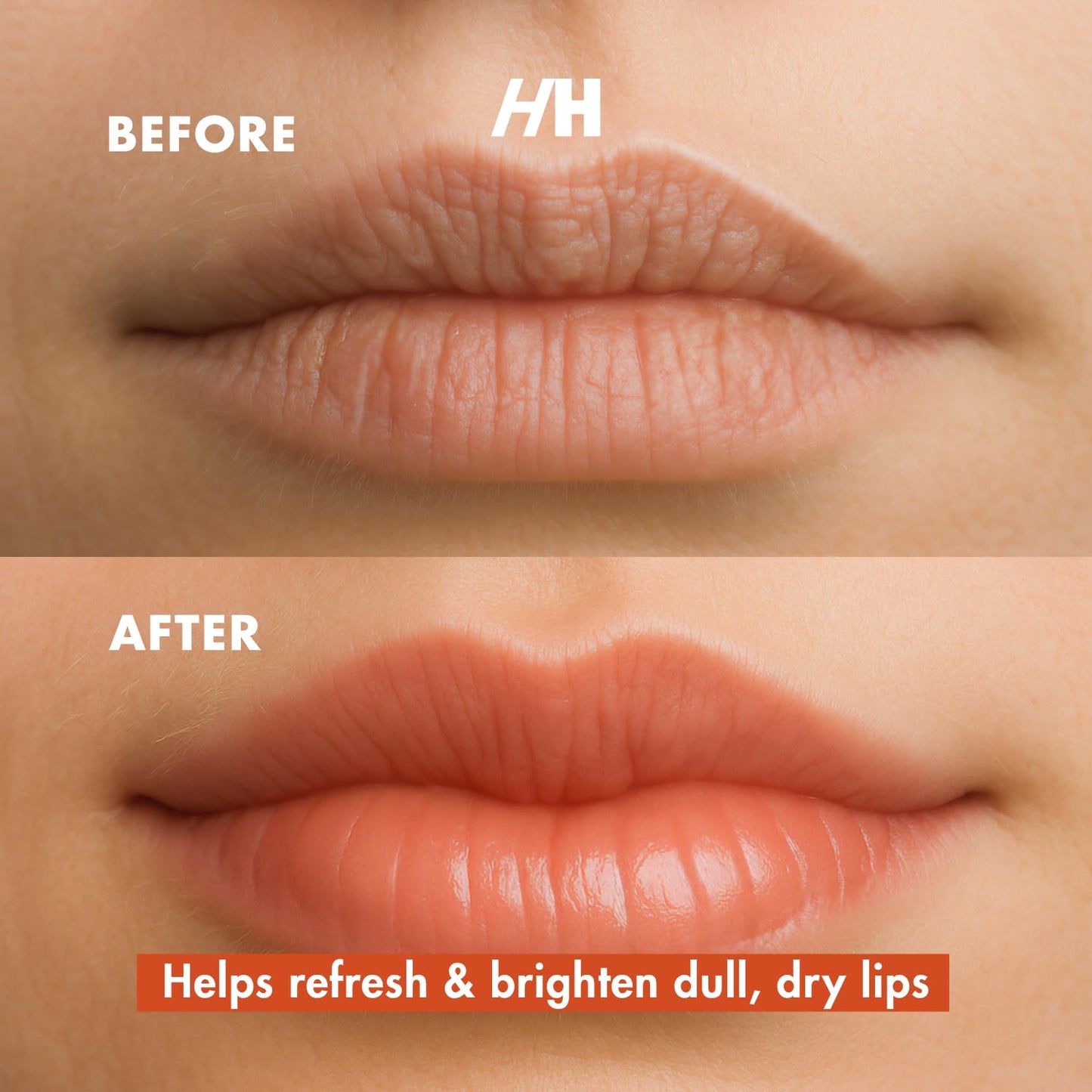 Handmade Heroes Turmeric Lip Scrub with Vitamin C – 100% Natural Vegan Exfoliant for Dark Dry Chapped Lips – Deep Conditioning Sugar Polish 1oz