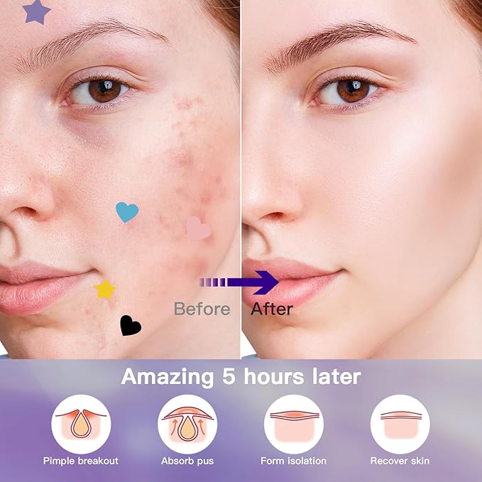 312CT Acne Patches For Face Hydrocolloid,Salicylic Acid,Star Pimple Patches 5Sizes 6Colors Cute Stickers