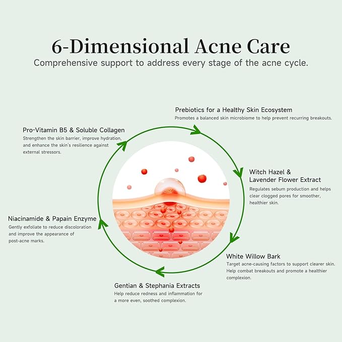 Gentle Botanical Acne Treatment for Face – Acid-Free Spot Facial Serum with Niacinamide & Witch Hazel, Soothes Redness & Controls Breakouts for Sensitive, Oily & Acne-Prone Skin – 1.2 ml × 30 Ampoules