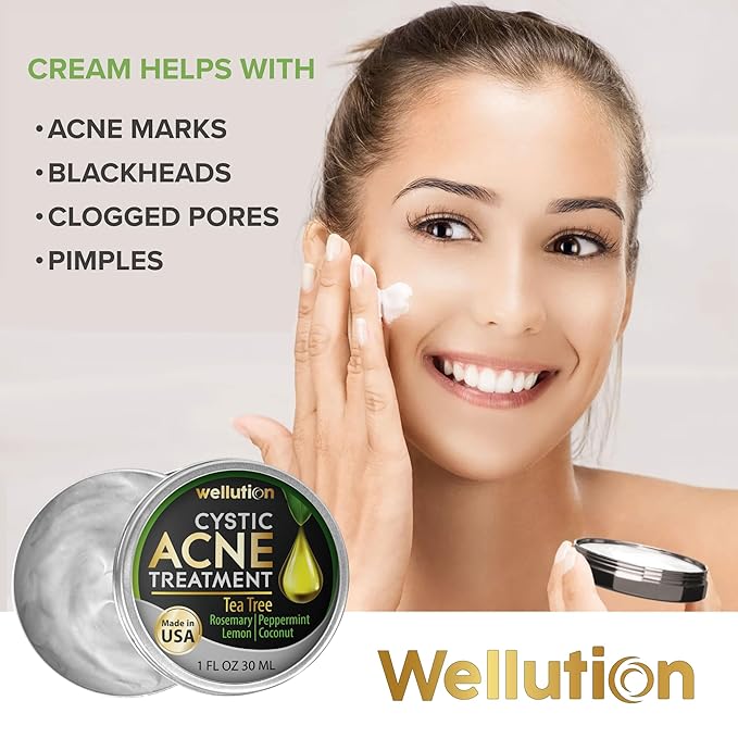 Cystic Acne Spot Treatment – Tea Tree Acne Cream – Fast-Acting Acne Spot Corrector for Face, Pimples & Blemishes – Non-Greasy, Gentle Formula – 1oz – by WELLUTION