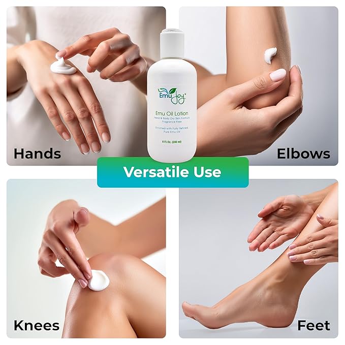 Emu Oil Infused Hand Lotion – Deep Moisturizing Cream for Dry & Cracked Hands Skin Relief – Perfect for Women, Men, and Travel | Natural Lotion with Shea Butter and Natural Oils - 8 oz