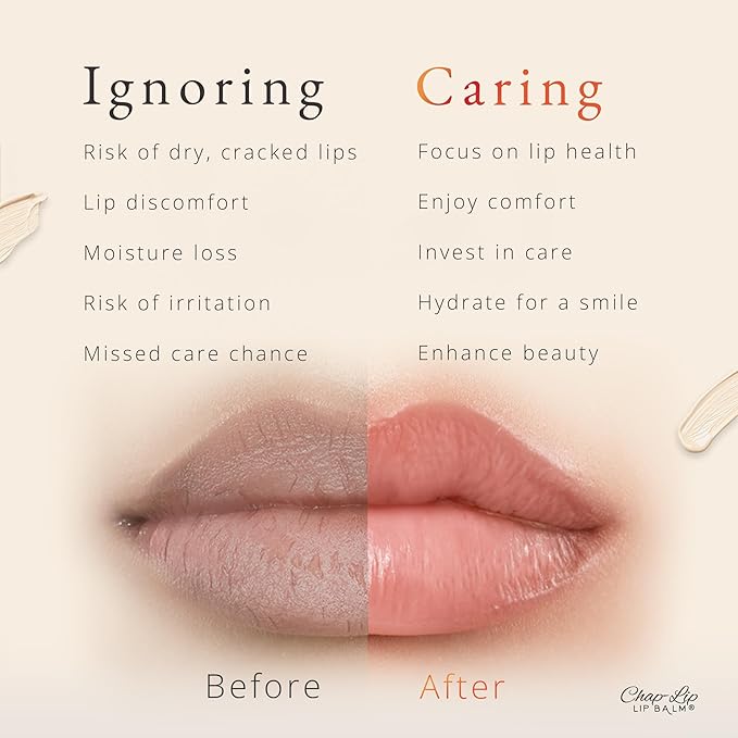 CHAP-LIP Lip Balm 60 Ct.