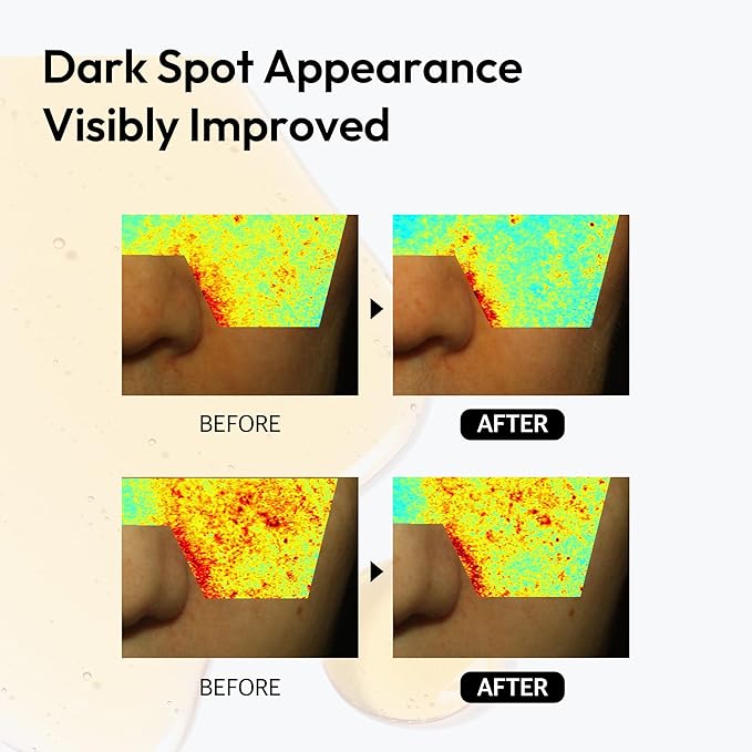 Dark Spot Correcting Serum for Face Korean Skin Care, Layerlab 10% Vitamin C Resveratrol Vitamin E Radiance Smoothing Dull Skin Tone Anti-Aging. Daily Pure Vitamin C 10% Serum 28ml 0.94 fl oz