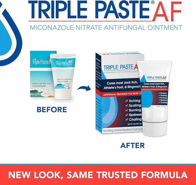 Triple Paste AF Anti Fungal Ointment for Skin Treats Most Athletes Foot and Ringworm - 2% Miconazole Antifungal Cream - 2 Oz Tube (Packaging May Vary)