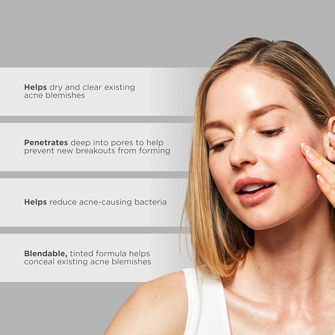 Glytone Acne Tinted Spot Treatment | Acne Cream with 8% Sulfur & 2% Resorcinol | Fast Acting Blemish Spot Treatment for face | Clears Breakout & Unclog Pores | Blemish Concealer | 1 fl oz