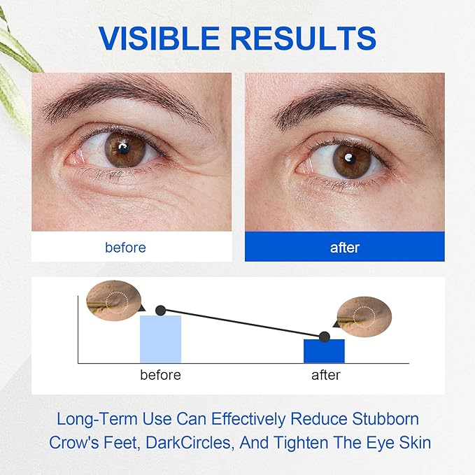 Retinol Eye Cream, Hydrating & Firming Under Eye Cream for Men, Reduces Dark Circles, Wrinkles & Puffiness, Nourishing Elastic Formula, 20g / 0.7 fl.oz