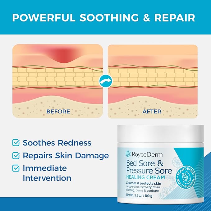 Bed and Pressure Sore Treatment Cream: Fast Healing Cream for Chafed Skin and Pressure Ulcers on Legs & Buttocks - Pressure Sore Relief for Bedridden, Elderly and Amputees - with Calendula - 3.5OZ