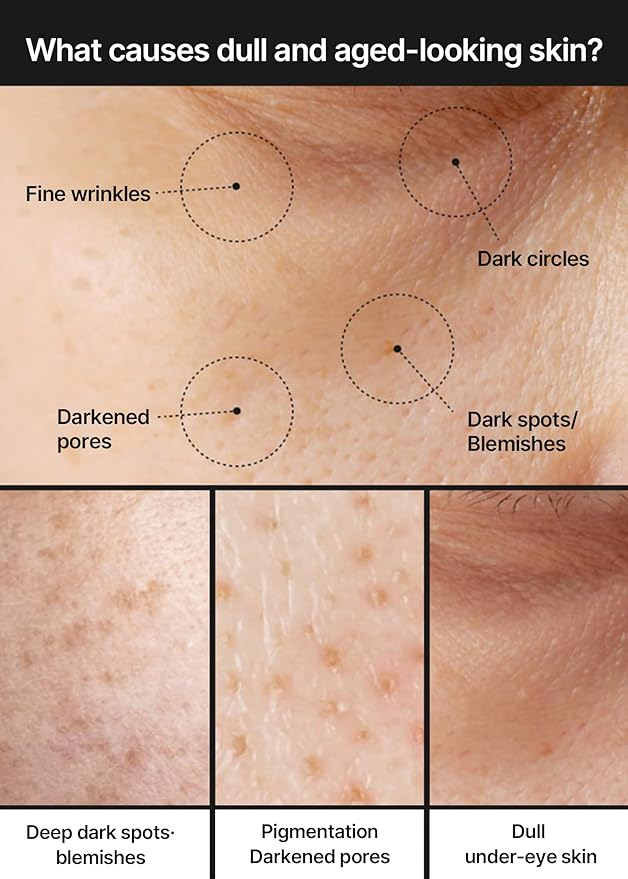 celimax Pore+Dark Spot Brightening Cream | with Niacinamide, Tranexamic Acid, TXA Cream, Pore Minimizer, Non-Irritating, Hydrating, For Sensitive Skin, 35ml