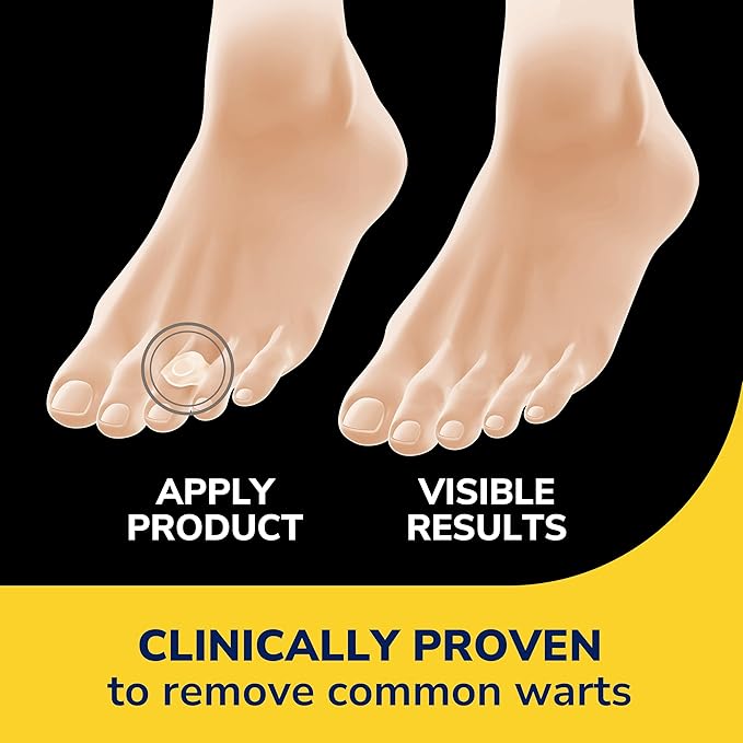 Dr. Scholl’s Clear Away Wart Remover Hydrogel Bandages for Fingers and Toes - Clinically Proven Effective Wart Removal and Cushioning Pain Relief, Comfortable Multi-Day Coverage Patches