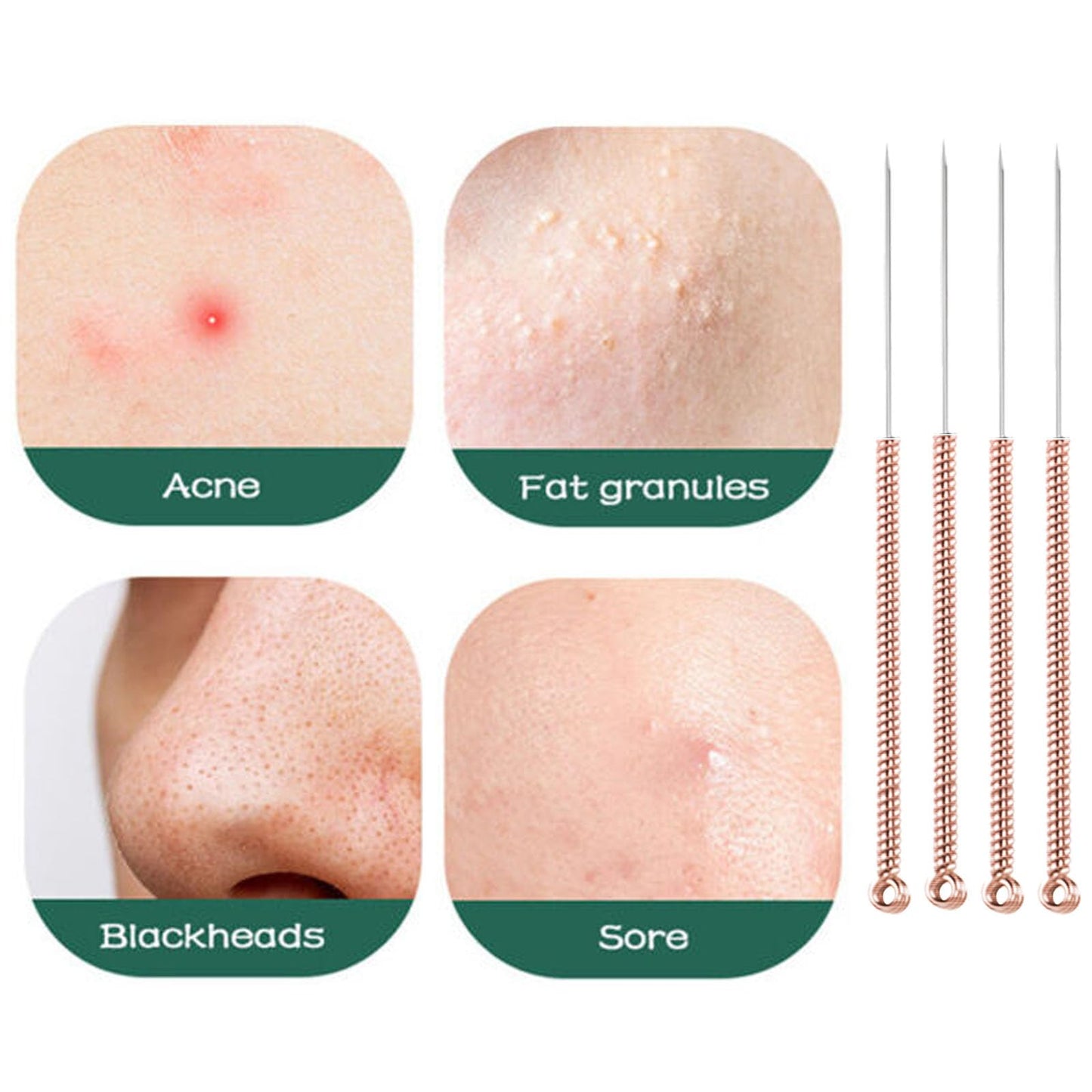 110 pcs Disposable Pimple Needles Acne Needle Blackhead and Blemish Remover Tools, Pimple Popper Tools Professional（Gold）