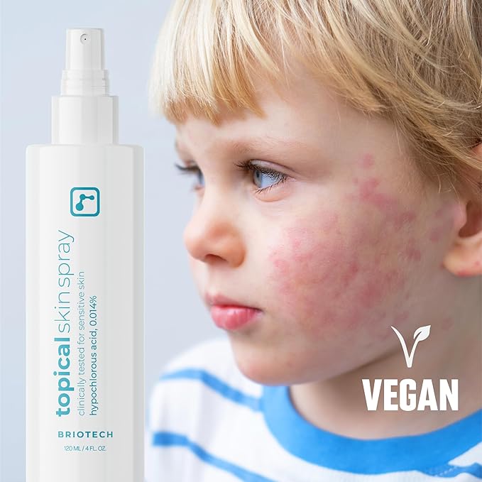 BRIOTECH Topical Skin Spray, Hypochlorous Acid Spray for Sensitive Skin, HOCl Facial Mist, Full Body Support Against Irritation, Calm Redness, Soothe Foot & Scalp, 2 oz Travel Size