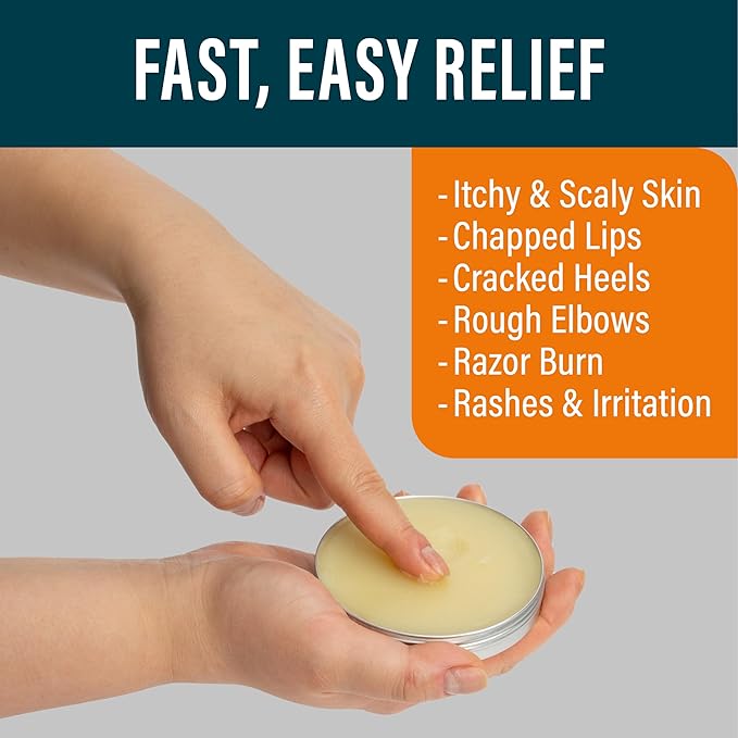 NUVADERMIS Tea Tree Oil Foot Balm – Effective Recovery Balm for Dry, Cracked Feet, Athlete’s Foot, Ringworm & Itchy Skin – Soothing Moisturizer – 2 oz
