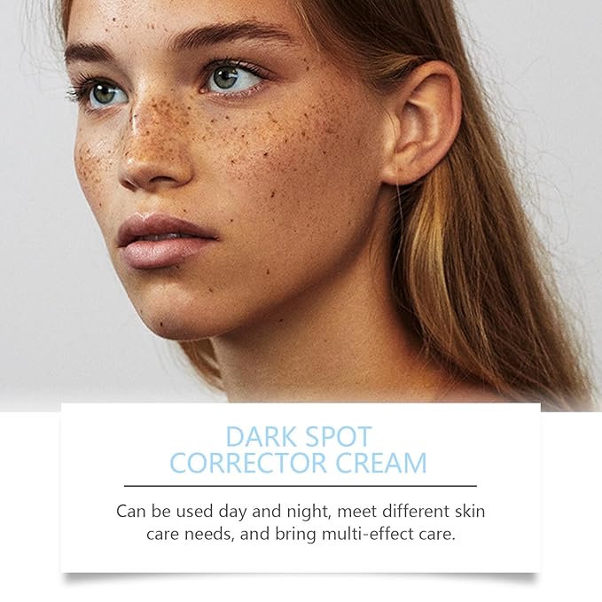 Dark Spot Corrector Cream with Retinol & Niacinamide Fade Age Spots, Sun Spots, Sun Damage & Uneven Skin Tone, Ceramide Barrier Repair + Hyaluronic Acid Hydration for/Serum/Women/Men（1 Fl Oz）