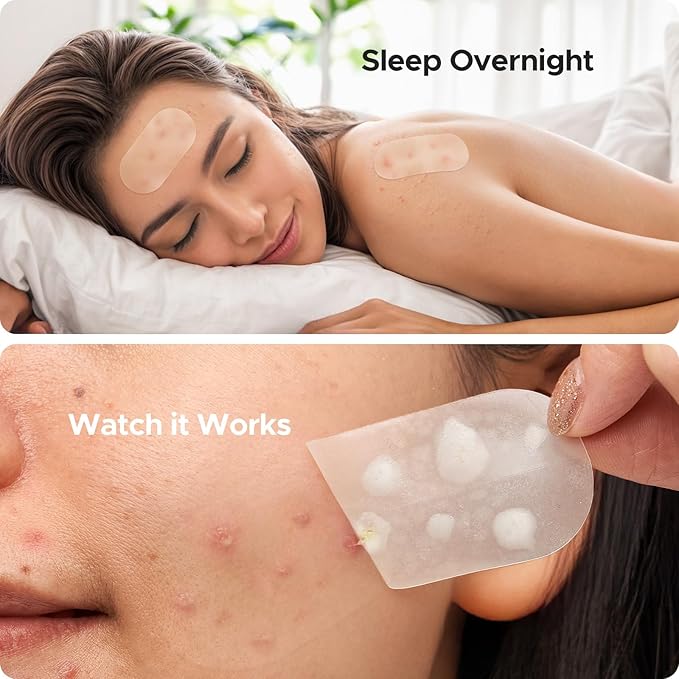 TKTK Large Pimple Patches for Face, 60 x 30 mm XL Acne Patches, Big Hydrocolloid Bandages for Body, Back, Forehead, Chin, Neck Blemish Zit Breakouts (Oval, Square, Dot 5 Sizes 124 Count)
