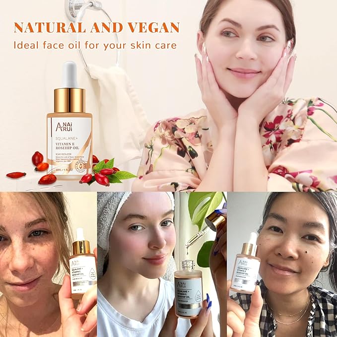 ANAI RUI Squalane + Vitamin E Rosehip Oil Moisturizer for Face Hydrate, Reduce Scars and Stretch Marks, Wrinkles for Smoother, Softer Skin 1 fl. Oz