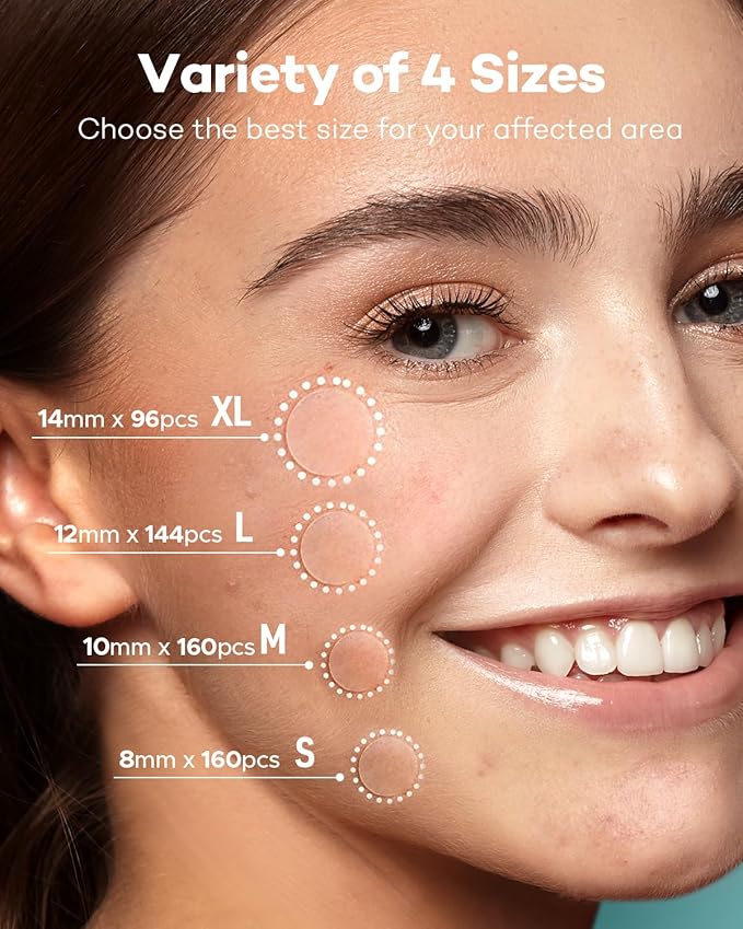 Pimple Patch Acne Patch, 4 Sizes 560 Patches Acne Absorbing Cover Patch, Hydrocolloid Invisible Acne Patches For Face Zit Patch Acne Dots Tea Tree, Calendula Oil - 4 Pack