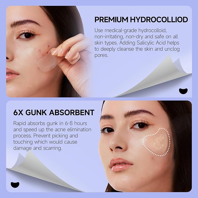Ultra Pimple Patch Variety Pack Hydrocolloid Acne Pimple Patches with Salicylic Acid for Covering Small & Large Zits and Blemishes, Spot Stickers for Face and Skin (36 Counts)