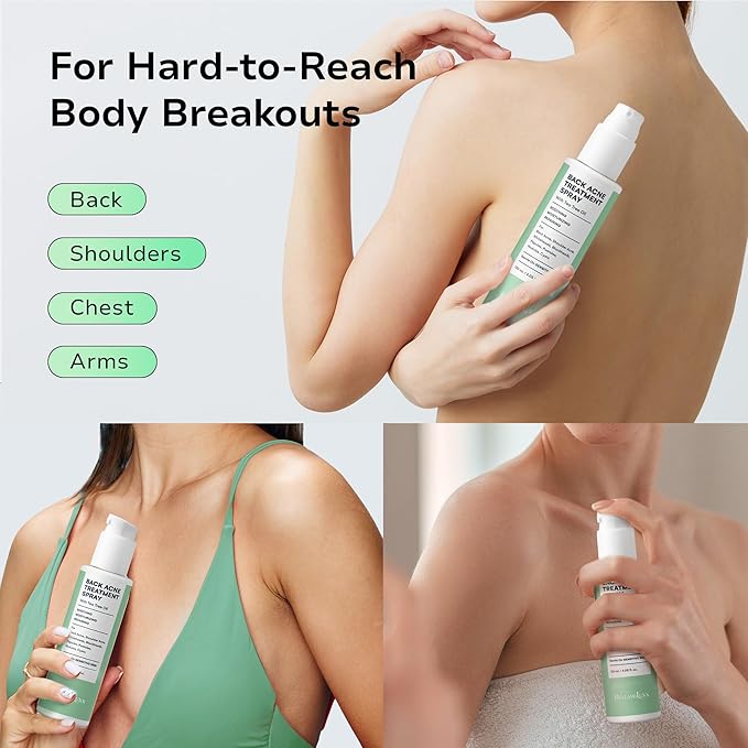 Body and Back Acne Treatment Spray: 2% Salicylic Acid & Tea Tree Oil Bacne Spray for Clear, Soothe & Moisturize - Effective for Men, Women, Teens with Back, Shoulder, Arm, and Chest Acne