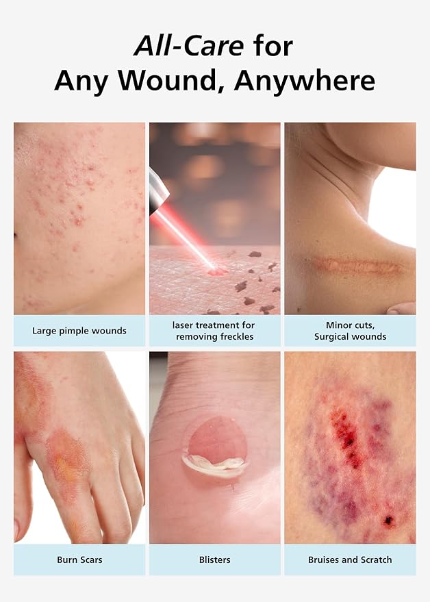 Easyderm Thin Hydrocolloid Large Wound Dressing 4”x4” 3Pack (6 Dressings) Waterproof, Latex Free, Highly Absorbent Dressing for Burns, Blisters, Acne Care and Wound Healing with Mini Scissor