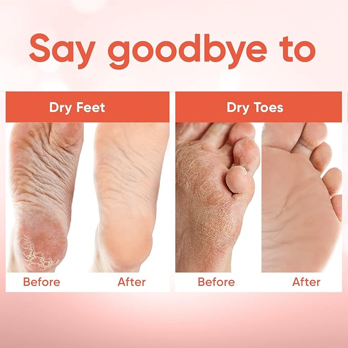 Foot Peel Mask - Foot Mask for Baby Soft Skin - Remove Dead Skin, Dry, Cracked Feet & Callus, Foot Spa, Made with Aloe Vera Extract for Women and Men (3 Pairs Peach)