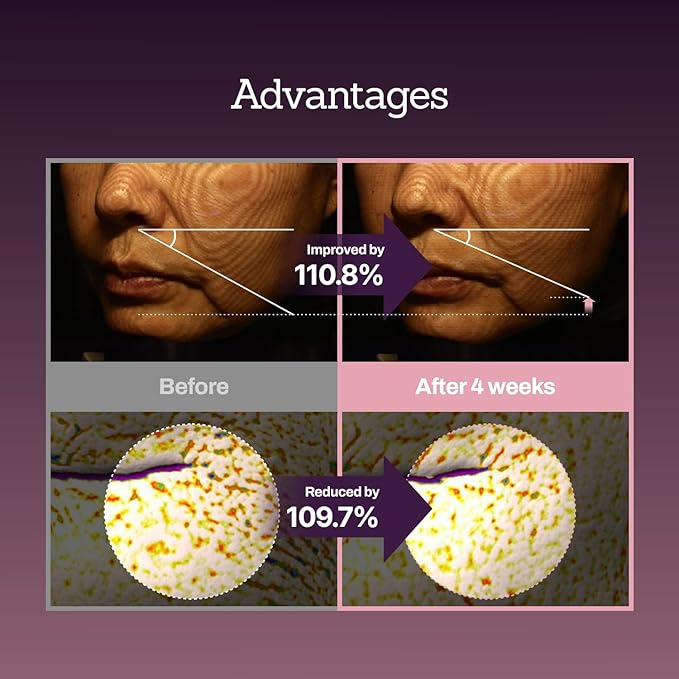 Collagen Peptide 12X Boosting Serum, Enhances Skin Elasticity & Reduces Deep Wrinkles, Promotes Collagen Production for Firm and Youthful Skin, Korean Skincare, 1.01 fl.oz