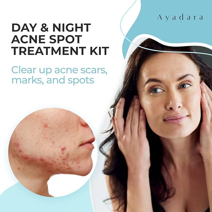 Day & Night Cystic Acne Spot Treatment, Hormonal Acne Treatment For Daytime & Overnight, Severe Acne, Cystic Acne Treatment for Face, Pimple Cream Tea Tree Bentonite Clay, 90 Day Supply