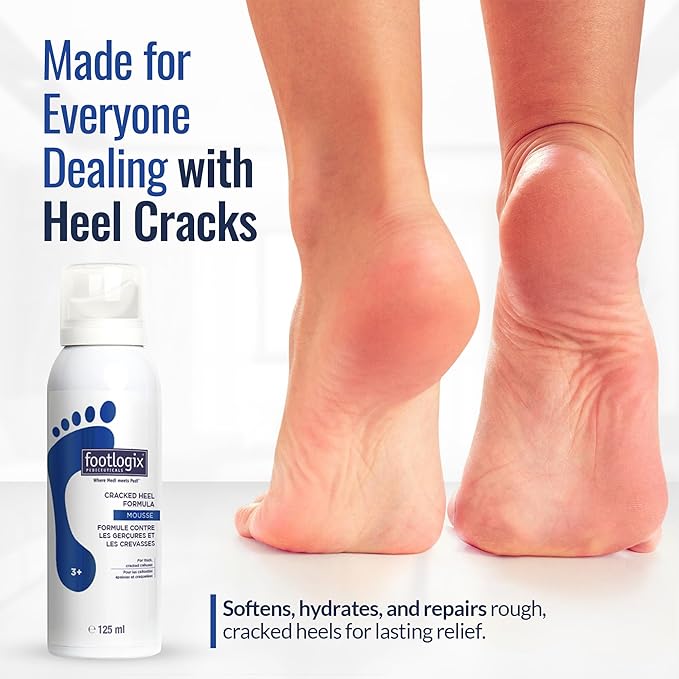 FOOTLOGIX Cracked Heel Formula, White 4.23 Ounce
