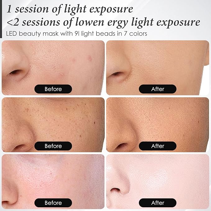 Red Light Therapy for Face, 7 Colors LED Face Mask Light Therapy At Home, Led Face Mask Light Therapy, White