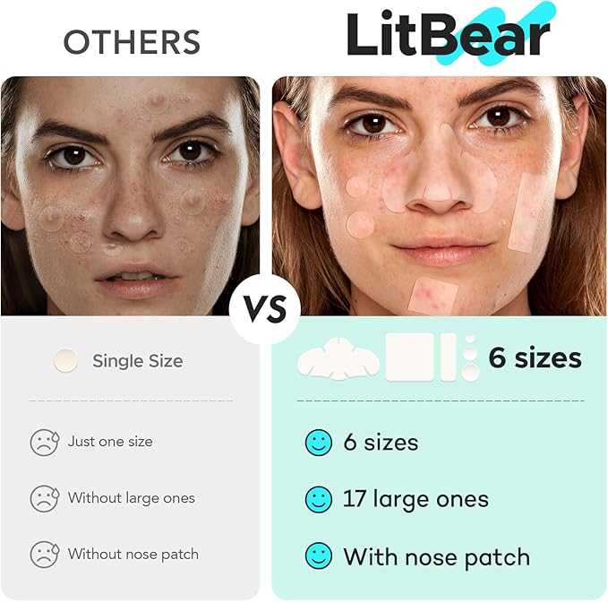 LitBear Large Pimple Patches for Face (6 Sizes 401 Counts), Big Hydrocolloid Acne Patches, XL Hydrocolloid Bandages for Body, Cheek, Forehead, Chin, Full Face, Back, Nose