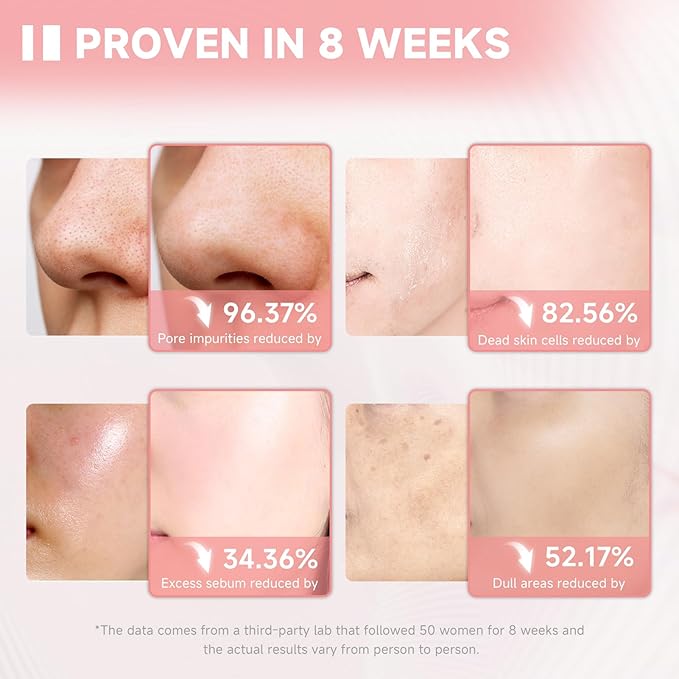 Salmon DNA PDRN Facial Cleanser | Low pH Hydrating Daily Foaming Face Wash with Soft Massage Heads | PDRN, Collagen & LHA | Gentle Pore Care & Radiant, Balanced-Looking Skin | 4.06 fl. oz