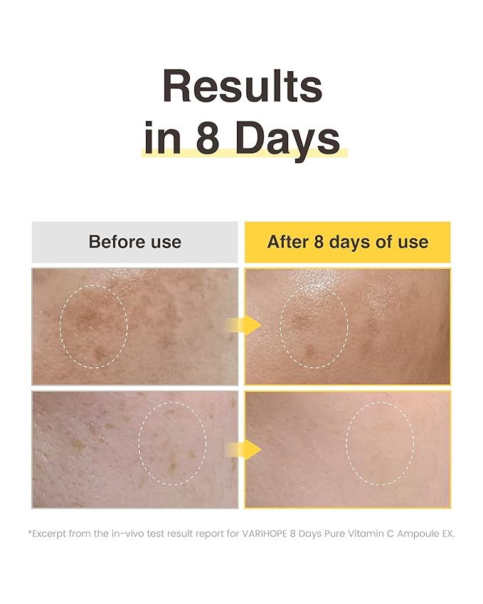 8 Days Vitamin C Serum - High-Potency Ascorbic Acid for Brightening, Dark Spot Care & Even Skin Tone, Korean Skin Care Ampoule for Glowing, Radiant Skin, 0.5 fl oz
