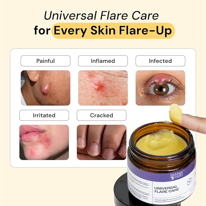 Universal Flare Care | Drawing Salve for HS, Boils, Cysts, Hemorrhoids, Pilonidal Cyst, Abscess | Anti-Chafing, Wound Care, Relief for Itching Skin w/Propolis & Egg Yolk Extract 1 oz