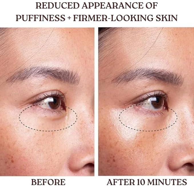 Beef Tallow for Skin - Organic Moisturizer Cream - 100% Grass Fed, Whipped - Anti-Aging, Deep Hydration Face Cream with Bakuchiol, Retinol Alternative for Wrinkle Repair, Eczema Relief & Brightening