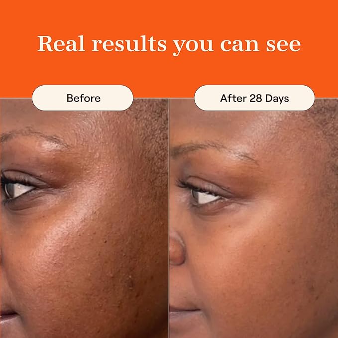 Live Tinted Superhue Hyperpigmentation Serum Stick Mini - Balm-to-Serum Stick For Face & Body - Skin Care with Niacinamide & Vitamin C, Facial Serum Stick for Dark Spots, 0.23 oz
