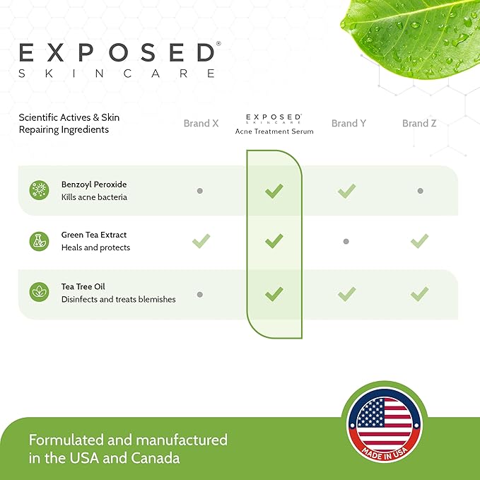 Exposed Skin Care Acne Treatment Serum – Lightweight Acne Spot Treatment with Micro Benzoyl Peroxide, Green Tea & Tea Tree Oil, Quickly Clears Pimples and Breakouts, 2.7 Fl Oz