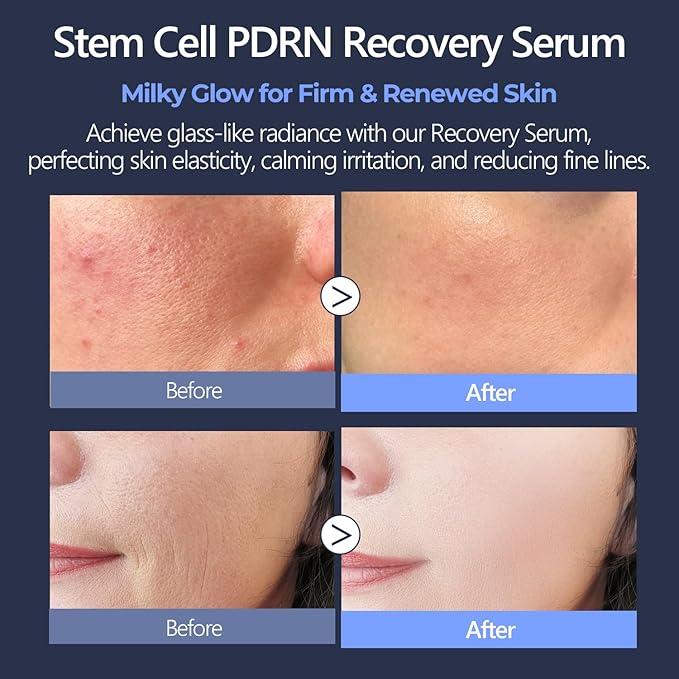Centella PDRN & CICA Exosome Stem Cell Serum for Face 1.01 fl oz - Anti-Aging, Firming & Rejuvenating Facial Serum with Bakuchiol & Ceramide, Korean Skincare for Wrinkles, Barrier Repair & Hydrating