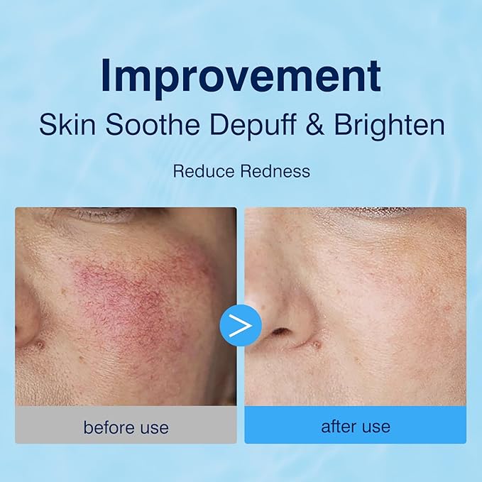 3% Hyaluronic Acid Collagen Peptide Toner Pad, Hyaluronic Acid Toners Facial Pads Jelly Pad for Face Hydrating Face Facial Treatment Toner Cotton Wipe for Women Smoothing All Skin Types 100 Pads
